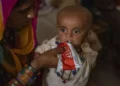 Pakistan critically short of supplementary food for acute child malnutrition: Unicef